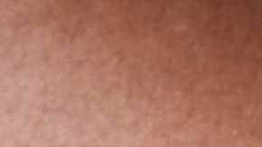 mujer con dolor abdominal