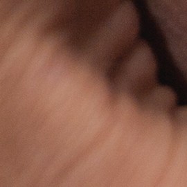 Encuentra el tratamiento para adelgazar y eliminar la celulitis, adecuado para ti, entre estas opciones disponibles en Groupon