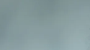 Mujer echandose crema aclaradora de manchas