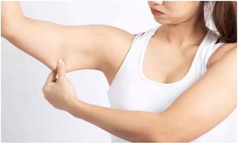Dos tratamientos no invasivos de reduccion de grasa en los brazos con láser en LA Slim