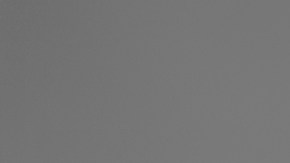 Elimina la celulitis de la piel de tus piernas con estos productos disponibles en Amazon