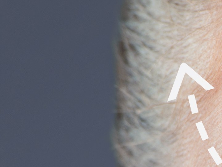 Pure Lift Face: la joya de la corona en tonificación facial. Con tecnología de triple onda y una potencia de 7.300 microamperios, este dispositivo supera las expectativas. Descubre por qué este tratamiento de 10 minutos al día puede ser la clave para deshacerte de la hinchazón, definir contornos y lograr una apariencia rejuvenecida.